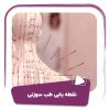 فیلم نقطه یابی طب سوزنی
