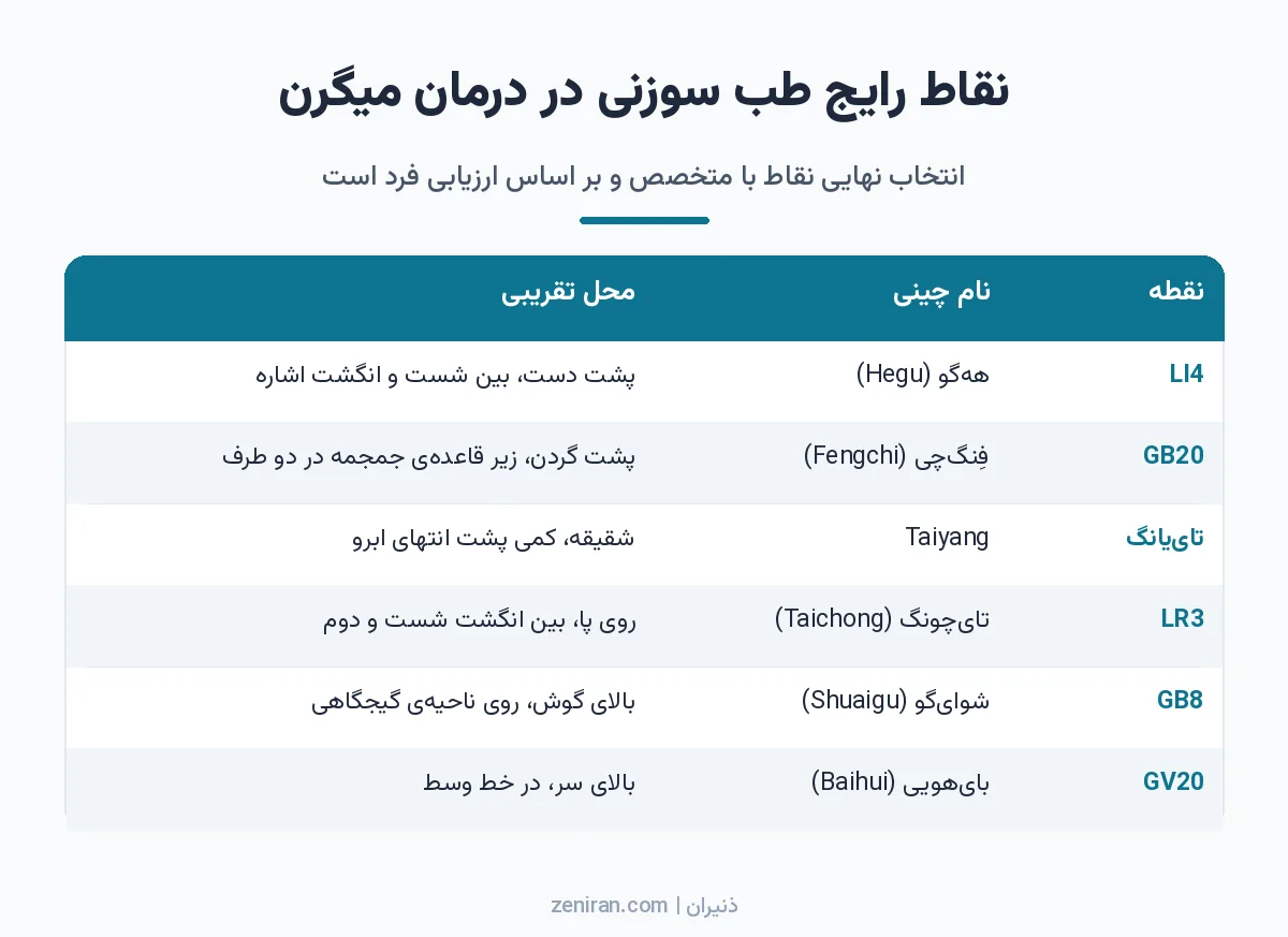 جدول شش نقطهی رایج طب سوزنی برای میگرن شامل LI4، GB20، تاییانگ، LR3، GB8 و GV20 با نام چینی و محل تقریبی